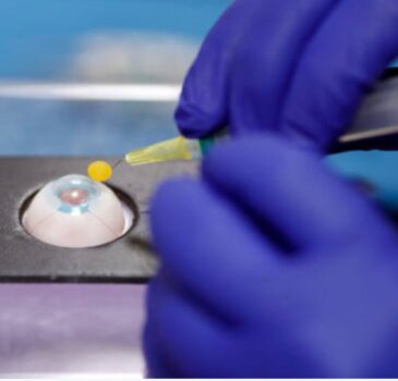 Implant-Supported Prosthetic Eyes Implant-Supported Prosthetic Eyes